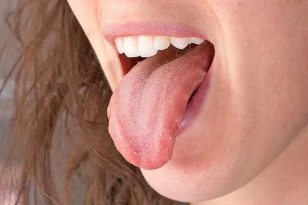 Estos son los colores de la lengua que pueden indicar problemas de salud, según la ciencia