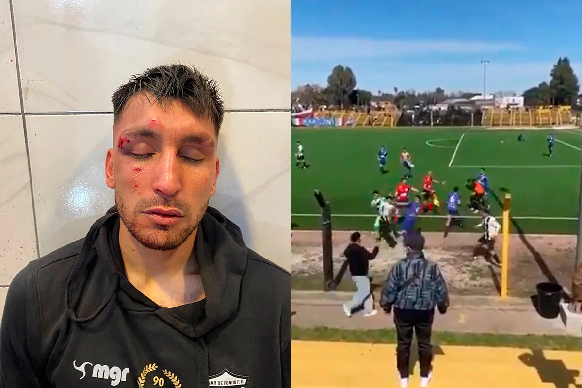 LAMENTABLE. Así quedó un futbolista de Mar de Fondo, luego de los incidentes en el estadio.
