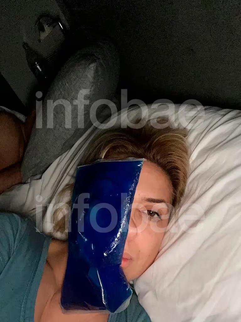 Las nuevas fotos que aportó la querella donde se ve a Fabiola Yáñez con moretones en la cara