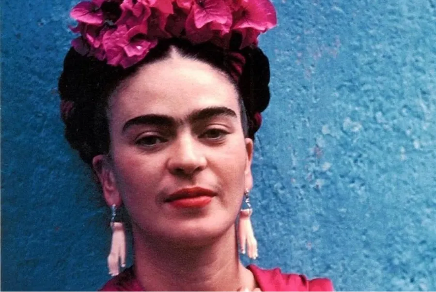 Frida Kahlo sufría un síndrome raro
