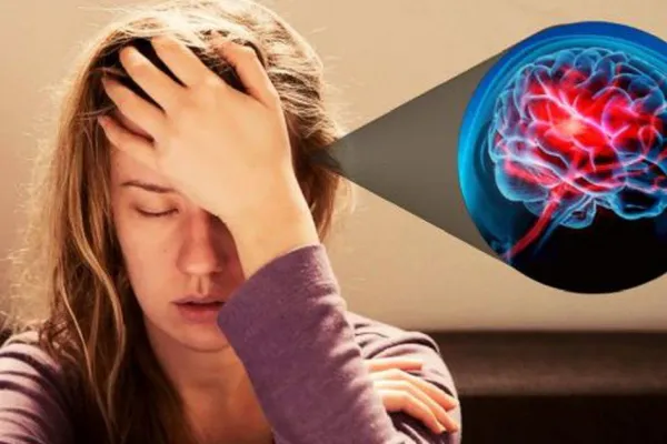 ¿Cómo saber si un dolor de cabeza es señal de un derrame cerebral?