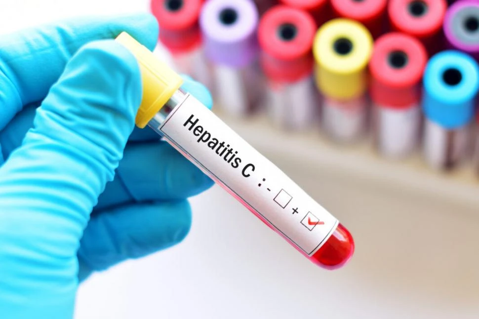 Buscan pacientes con hepatitis C