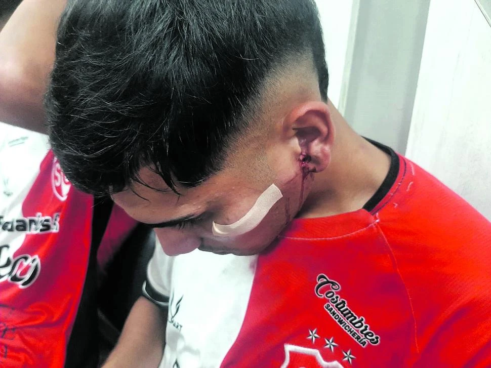 AGRESIONES. Las fotos muestran las secuelas que dejó la violencia que desataron hinchas de Atlético Concepción sobre jugadores de Sportivo Guzmán.