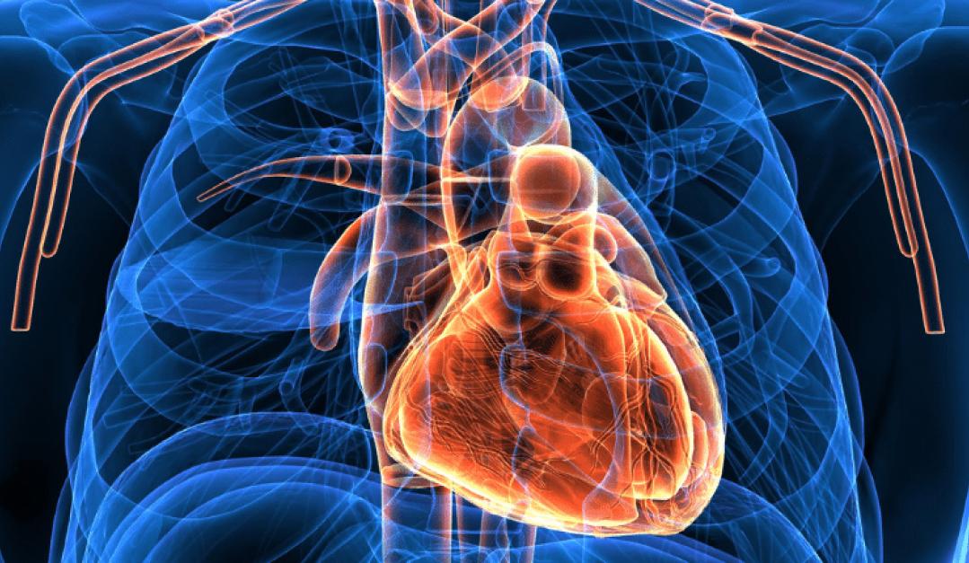 La insuficiencia cardíaca se produce por la incapacidad de nuestro corazón de bombear sangre. 