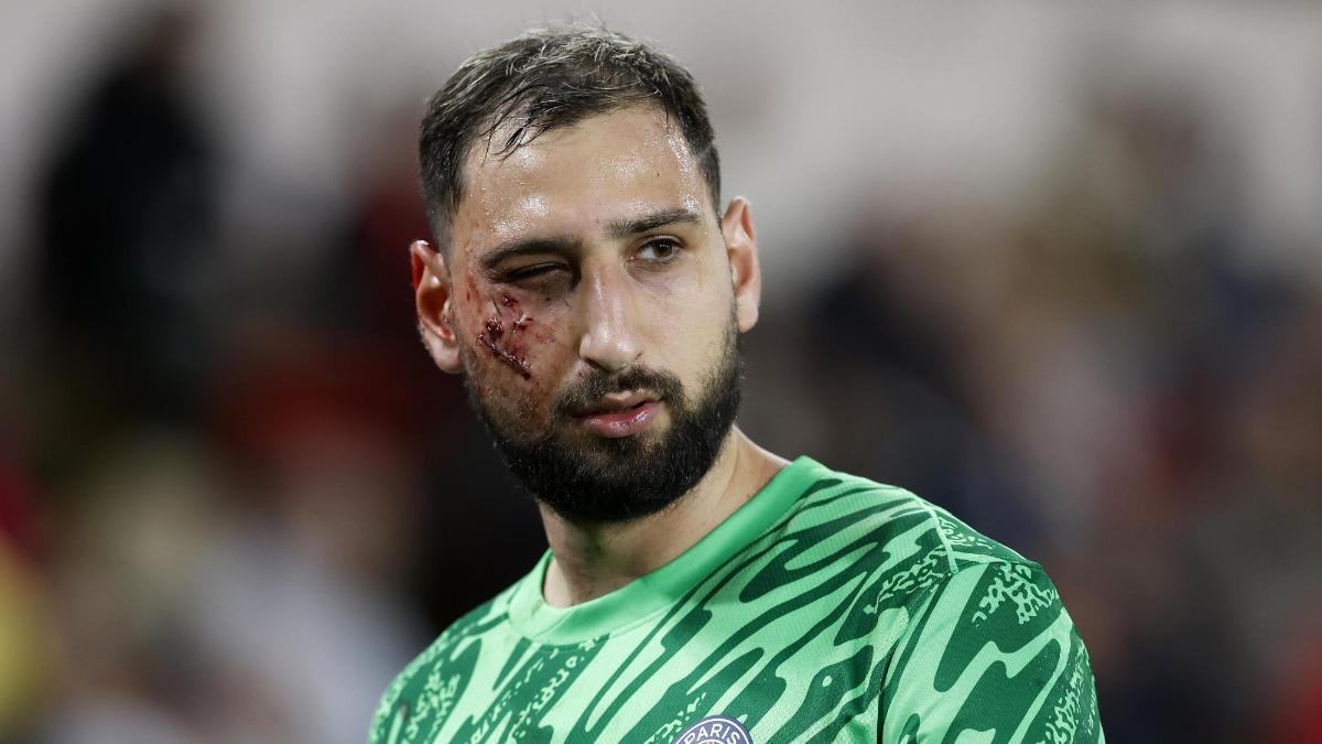 Le cerraron la herida con una abrochadora: las impactantes imágenes del rostro de Donnarumma tras recibir un planchazo