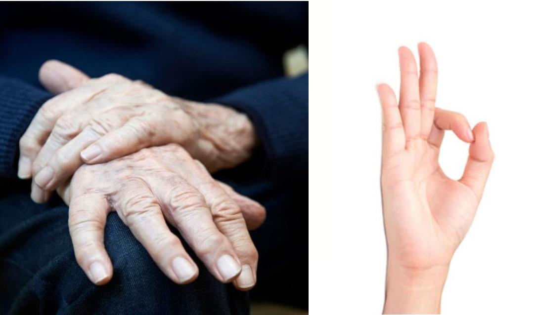 El índice y el pulgar suelen unirse y tener movimientos similares a los que se hacen al rascar o intentar limpiar migas de los dedos.