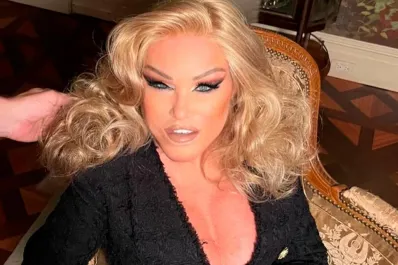 Murió Jocelyn Wildenstein: la fascinante y trágica historia de la “mujer felina”