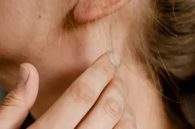 ¿Cómo empieza el cáncer de tiroides? los síntomas a los que debemos estar atentos