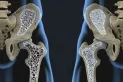 Este es el ejercicio que deberían realizar los mayores de 50 años para prevenir la osteoporosis