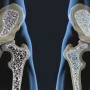 Mayores de 50 años: el ejercicio clave para fortalecer los huesos y prevenir la osteoporosis