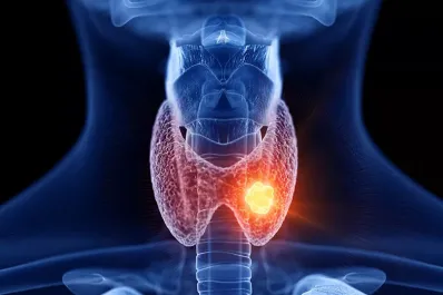 ¿Hipotiroidismo o hipertiroidismo?: los signos clave para diferenciar ambas afecciones