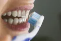 No es bicarbonato: el método efectivo para eliminar el sarro dental y lograr dientes más blancos