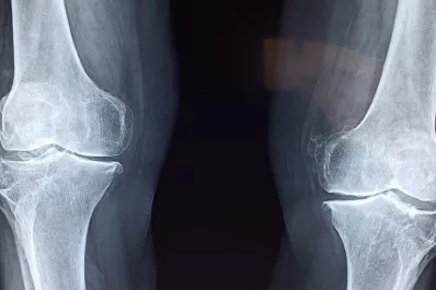 La semilla repleta de calcio y magnesio que todos recomiendan para tener huesos fuertes