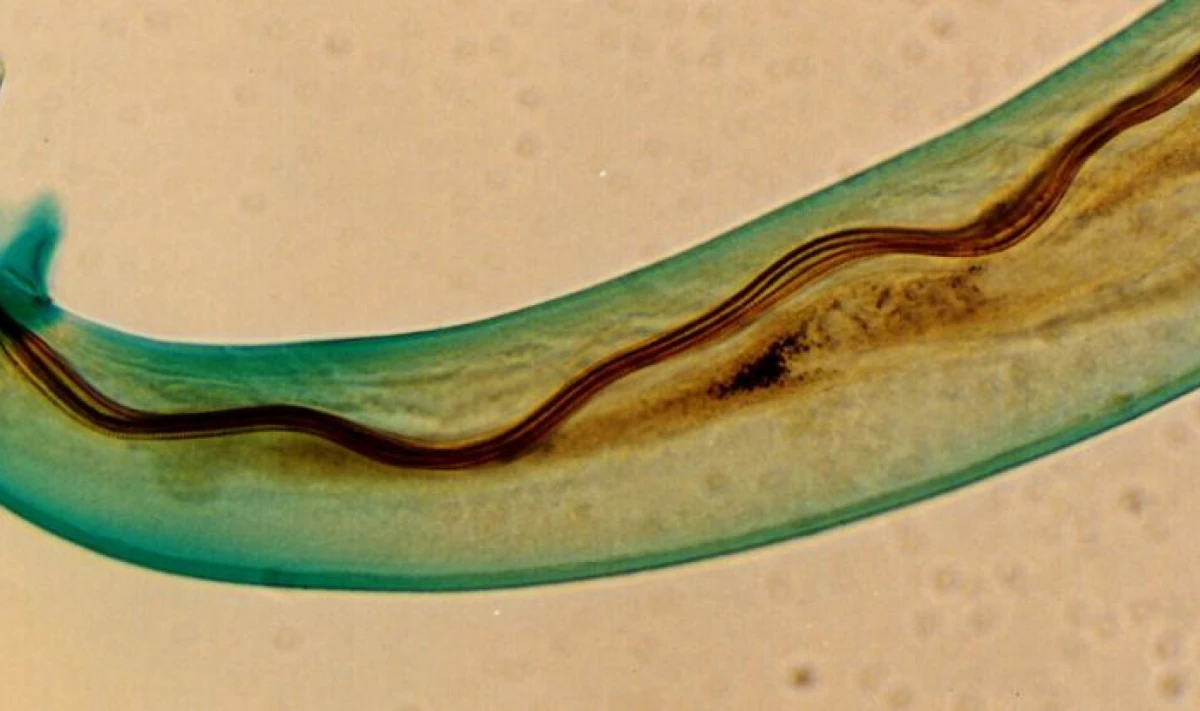 l parásito A. cantonensis. (Punlop Anusonpornperm/Wikimedia Commons/Live Science)