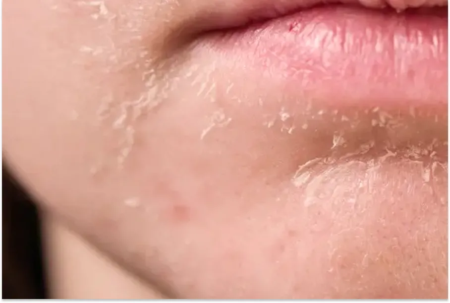 En sus estadíos más extremos, la deshidratación puede complicar diversos órganos.