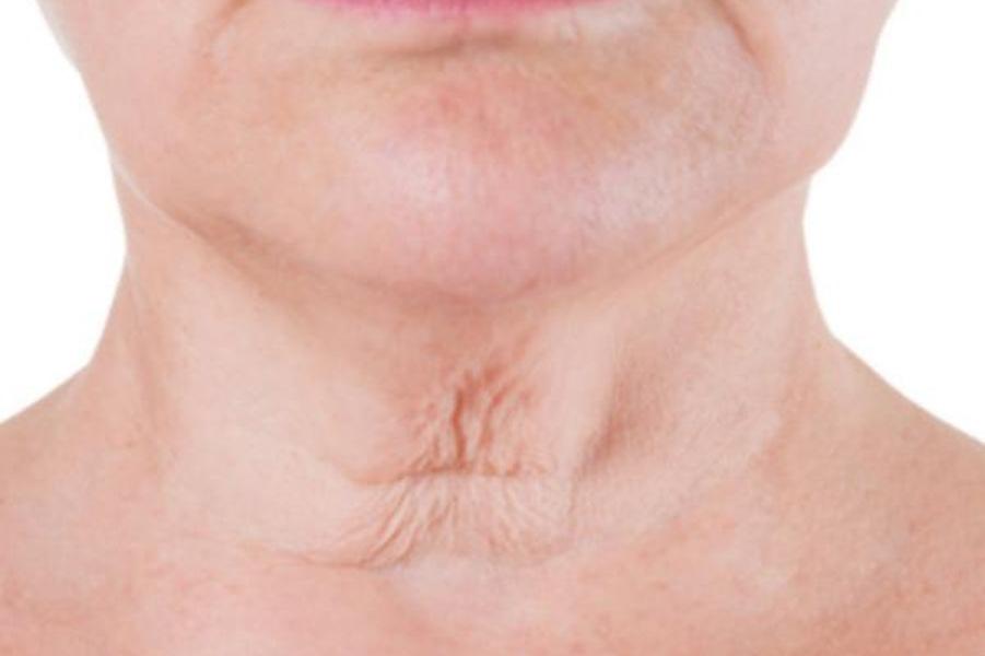 Es habitual notar cambios en la firmeza de la piel a partir de los 30 años.