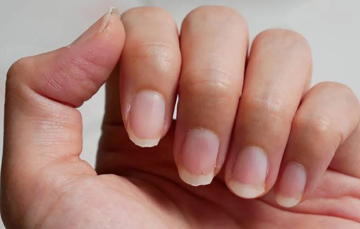 El inesperado síntoma de cáncer de pulmón.