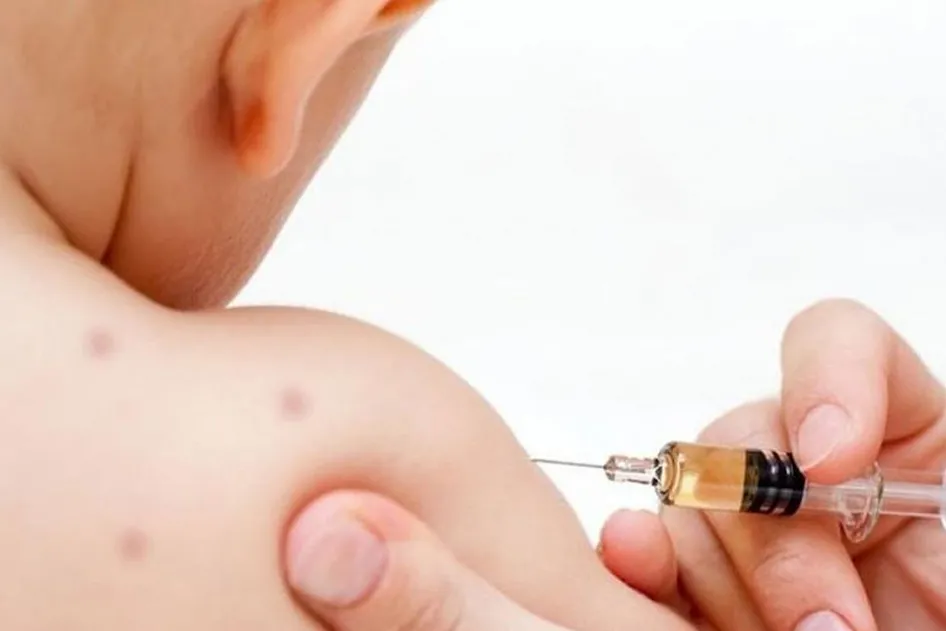 Sarampión. Una enfermedad que afecta principalmente a niños pequeños pero de la que los adultos no están a salvo.