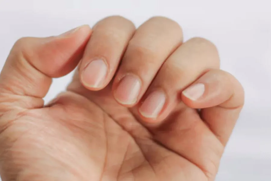 Un nuevo estudio vincula el crecimiento de las uñas con la esperanza de vida