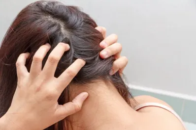 ¿Cómo detectar si tu cuero cabelludo está dañado?: señales clave para tratarlo a tiempo