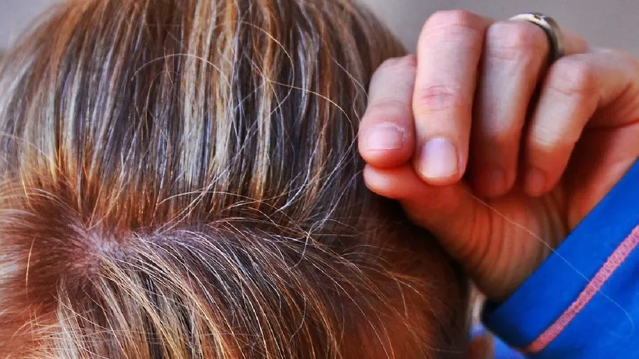 Muchas personas se sienten incómodas con las canas y se las arrancan de manera agresiva