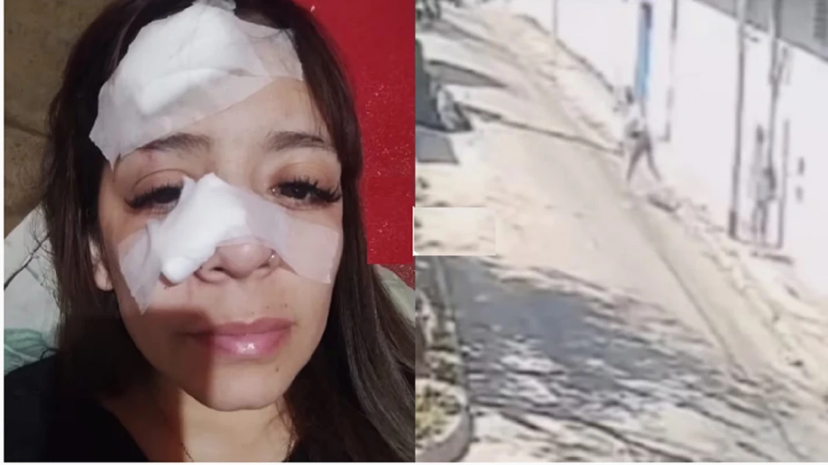 Una mujer se negó a darles comida a dos personas y le fracturaron la nariz con una piedra