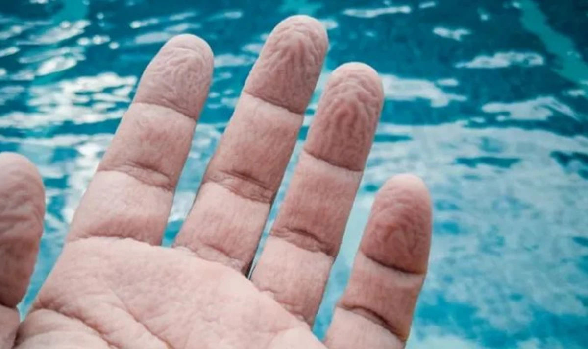 Así quedan tus dedos después de una tarde de piscina.