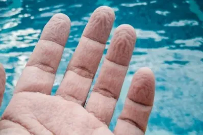 ¿Las arrugas de los dedos mojados son iguales en todas las personas?