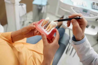 Implantes dentales: las tres claves que debés tener en cuenta antes de hacerte uno