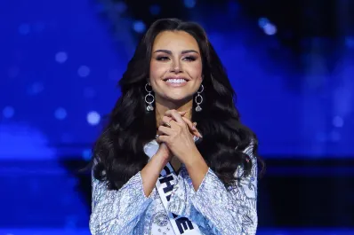 Emilia Dides mostró las cicatrices de su impactante accidente de auto: Creí que todo se rompía