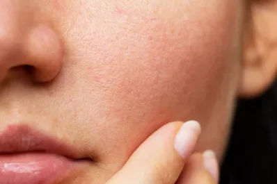 Diez recomendaciones para cuidar la piel del frío en el invierno