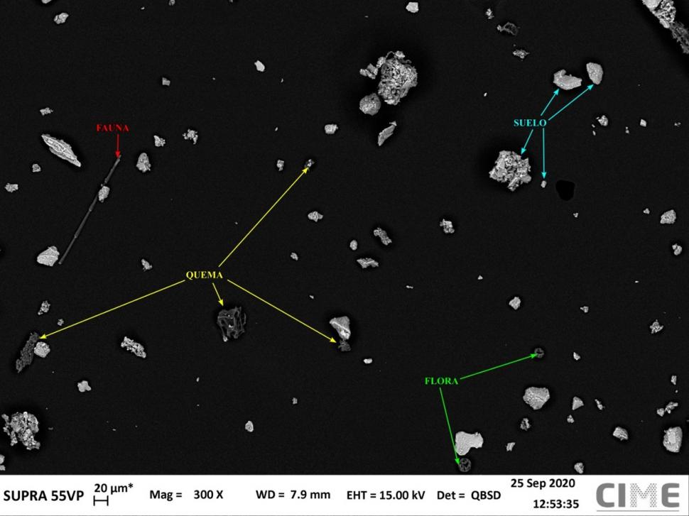 ASÍ SE VEN EN EL MICROSCOPIO. En la imagen queda precisado el origen de cada una de ellas. Los tamaños varían en todos los casos.