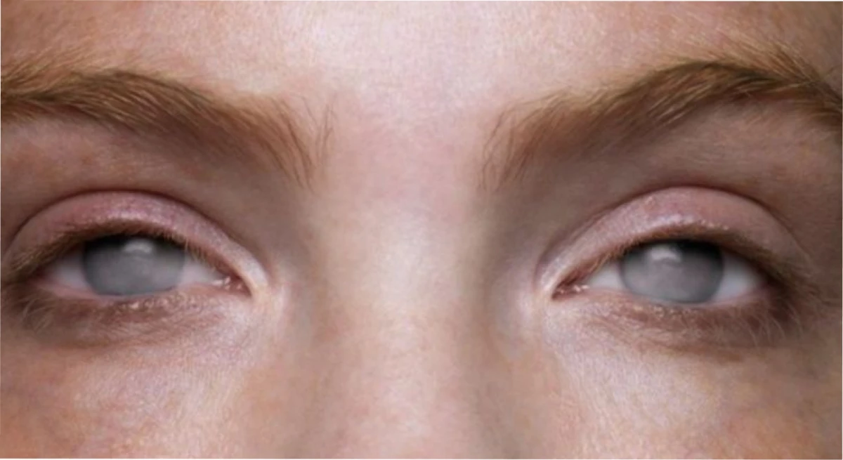 Nuestro cerebro se las arregla para seguir viendo después de la ceguera.