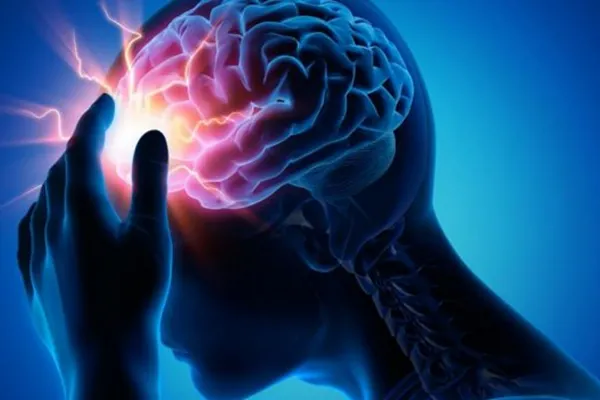 Qué es un ACV isquémico, el cuadro por el que quedó internada la Locomotora Oliveras