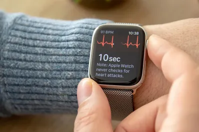 Apple habilitó en Argentina la función para hacer un electrocardiograma con un reloj