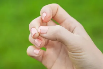Uñas fuertes y saludables: la proteína clave y los alimentos que debes incluir en tu dieta