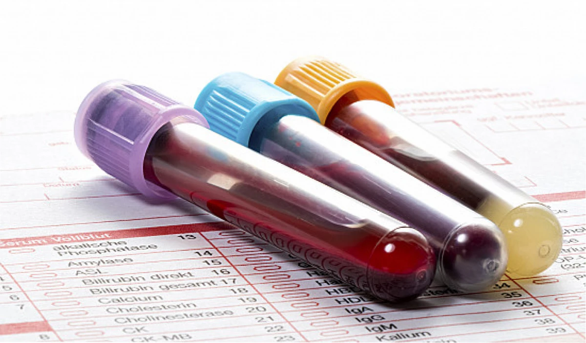 ¿Qué dice la sangre de las personas más longevas?