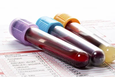 Claves para vivir más de 100 años: lo que la ciencia encontró en la sangre de los longevos