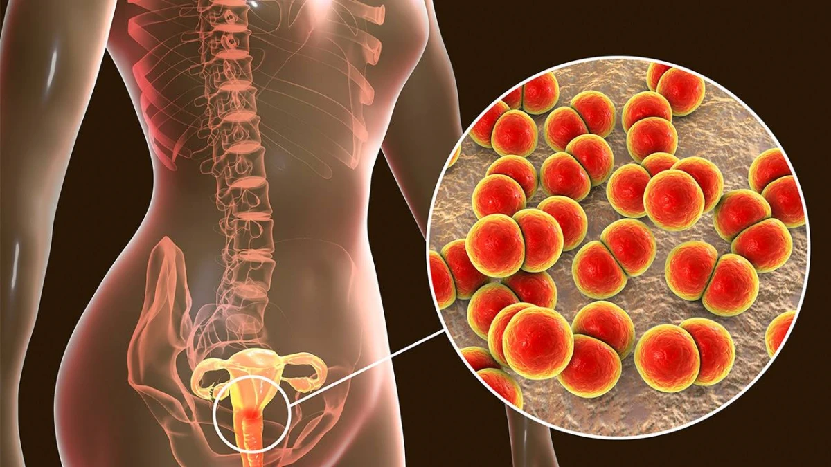 La gonorrea bate récord de contagios en España