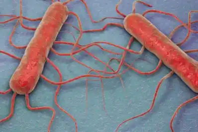 Bacteria en quesos: que es lysteria monocytogenes y cómo prevenirla