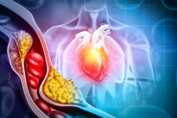 Colesterol: seis mitos peligrosos que podrían estar dañando tu salud