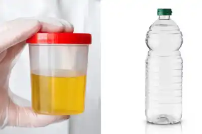 ¡A que no lo sabías! Para qué sirve mezclar vinagre con orina