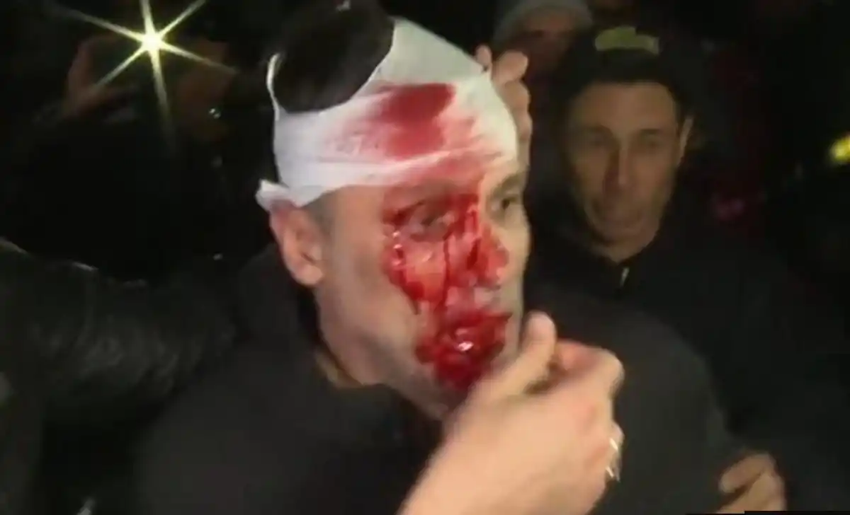 Incidentes en el acto de Milei en Moreno: a un periodista le dieron un botellazo en la cabeza