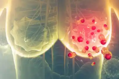 Cáncer de mama: cuáles son los primeros síntomas y cómo identificarlos a tiempo