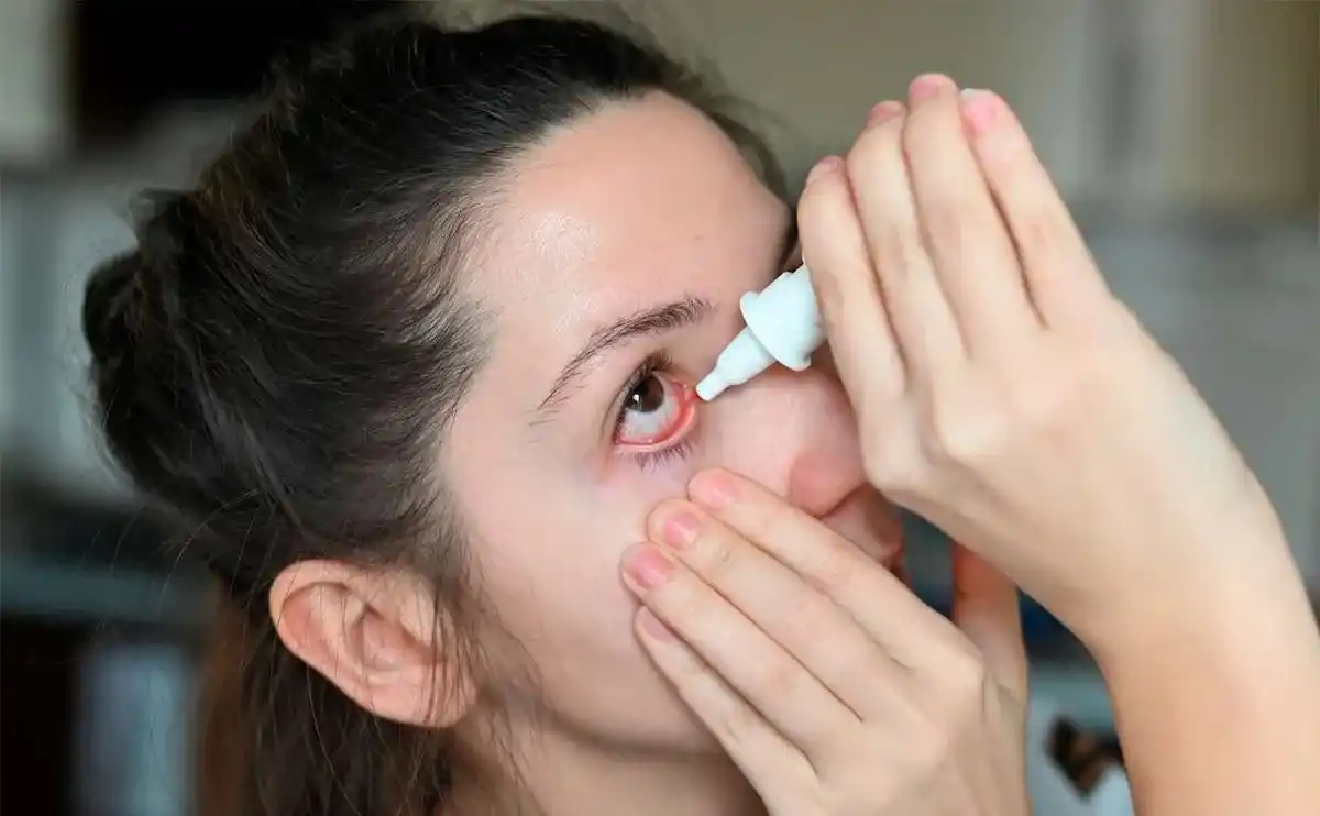 Imagen de https://elnacionaldeoklahoma.com/la-conjuntivitis/