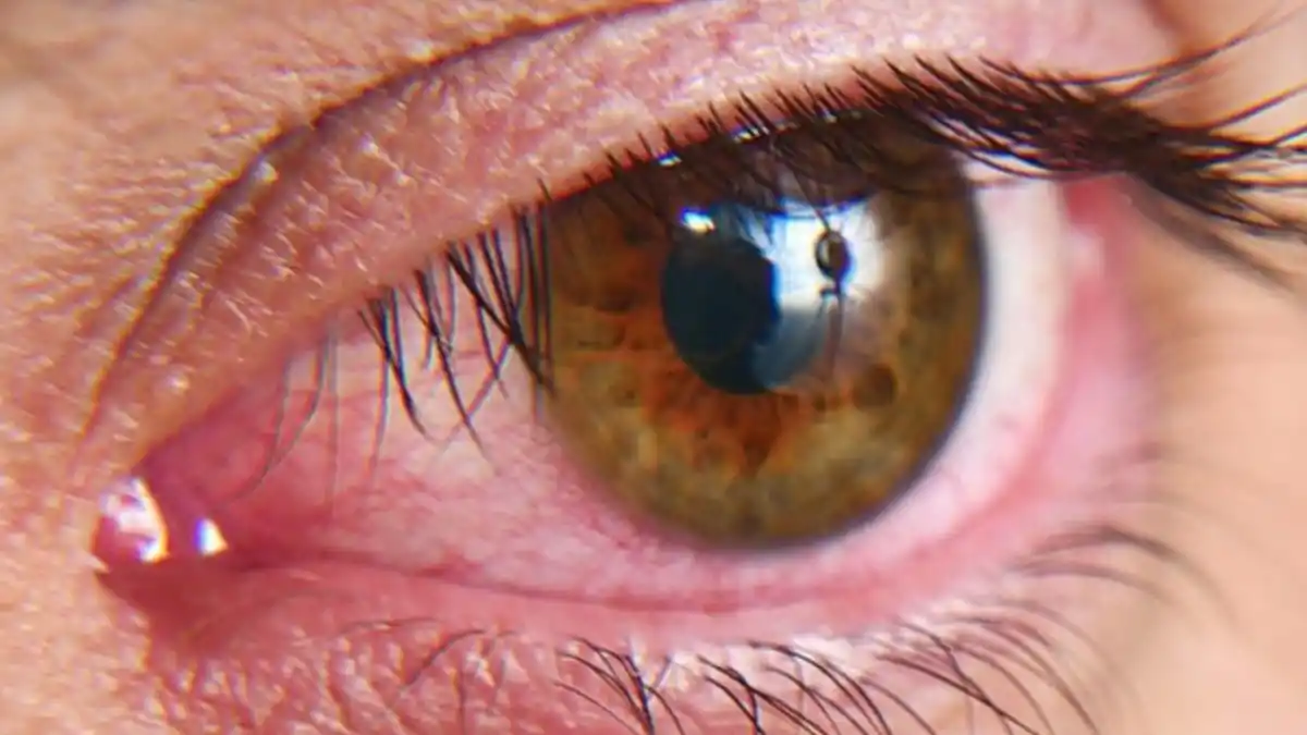 El ojo seco, un problema cada vez más frecuente: ¿cuándo se debe consultar a un especialista?