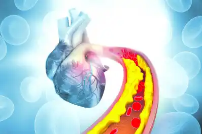 El colesterol es la primera causa de muerte mundial