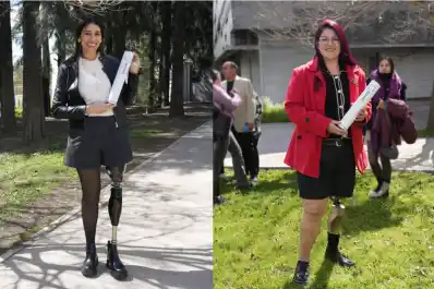 Estudiaron una carrera universitaria para crear sus propias prótesis y poder caminar