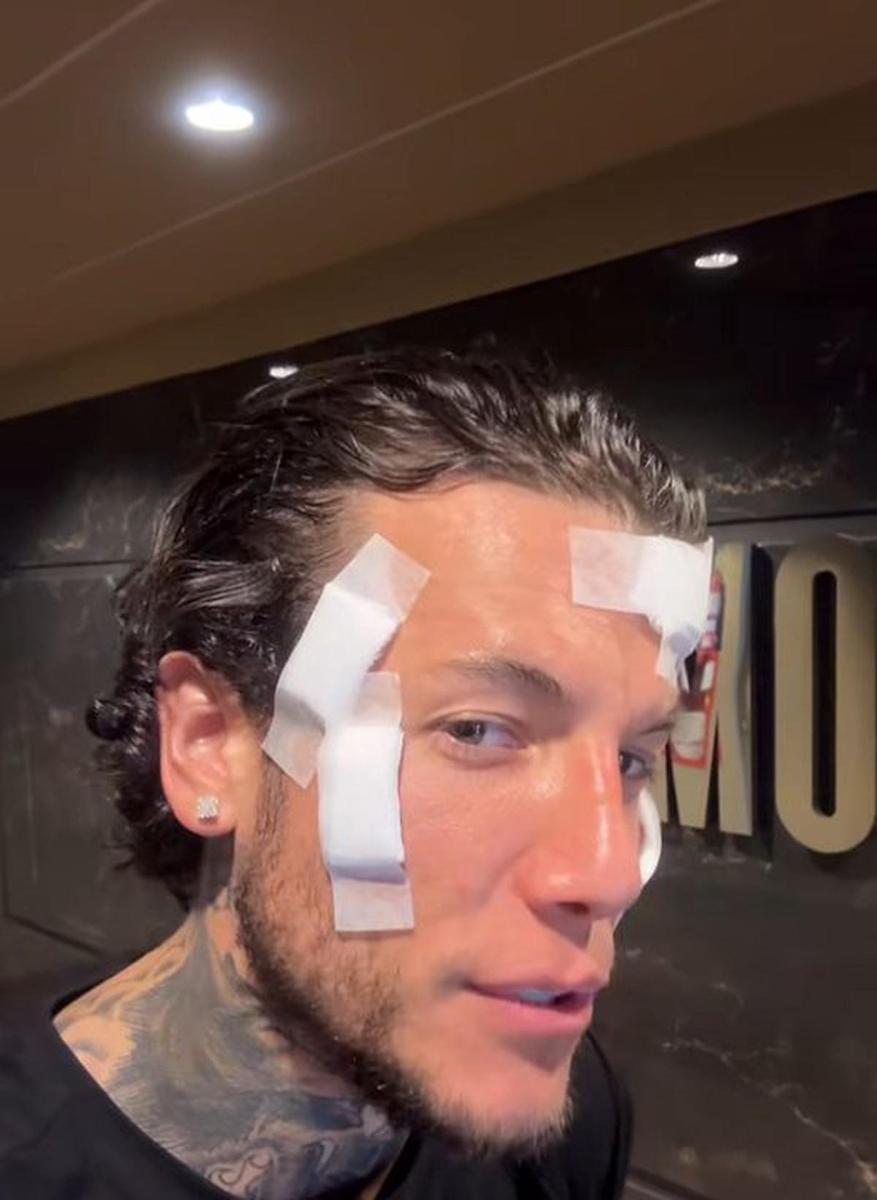 Alex Caniggia tomó una drástica decisión sobre su aspecto físico