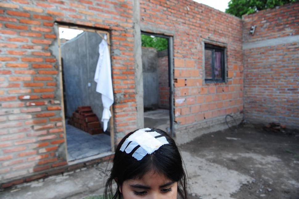 NAHIARA. La niña, con una venda en la cabeza en su casa inhabitable.